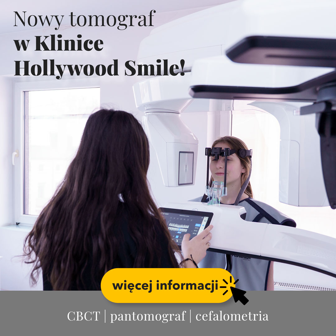Hollywood Smile