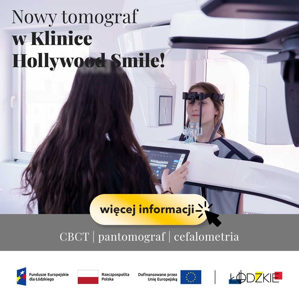 Hollywood Smile