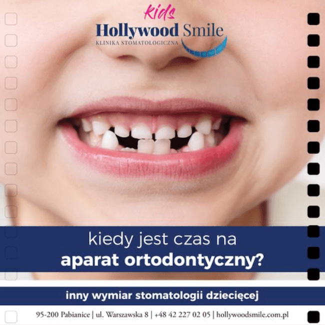 Hollywood Smile - news