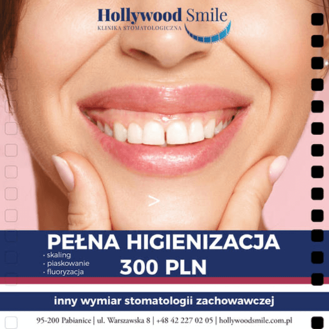 Hollywood Smile - news