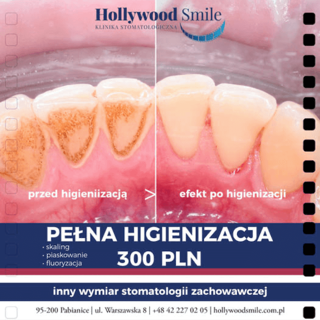Hollywood Smile - news